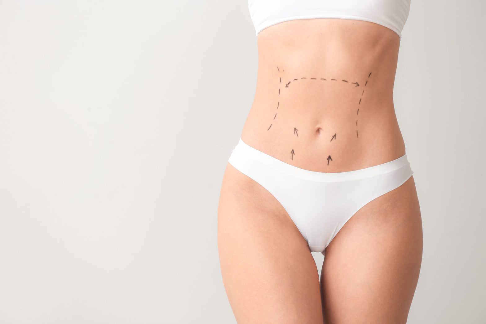 The Benefits and Recovery of a Mini Tummy Tuck: A Comprehensive Guide
